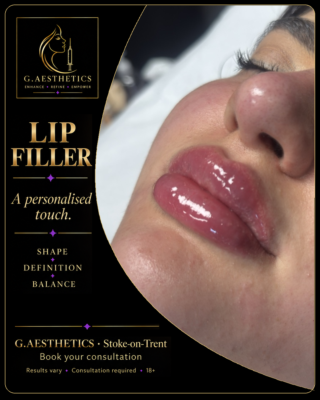 Original client lip filler photograph in the approved G.Aesthetics black and gold design
